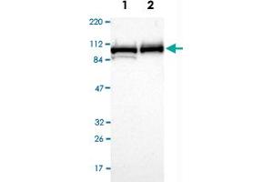 Western Blot analysis of Lane 1: RT-4 and Lane 2: U-251MG sp cell lysates with MCM4 polyclonal antibody . (MCM4 antibody)