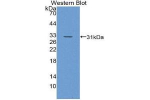 Western Blotting (WB) image for anti-Glutathione S-Transferase theta 1 (GSTT1) (AA 7-240) antibody (ABIN1868284)