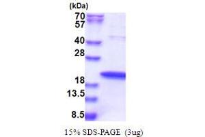 SDS-PAGE (SDS) image for Zinc Finger, HIT-Type Containing 1 (ZNHIT1) (AA 1-154) protein (His tag) (ABIN5853634)