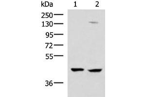 Western blot analysis of 293T and Jurkat cell lysates using MAGEC2 Polyclonal Antibody at dilution of 1:850 (MAGEC2 antibody)