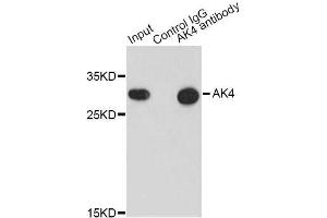 Immunoprecipitation analysis of 200ug extracts of HepG2 cells using 0. (AK4 antibody  (AA 1-223))