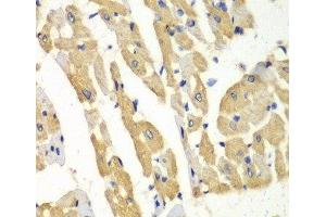 Immunohistochemistry of paraffin-embedded Mouse heart using HNMT Polyclonal Antibody at dilution of 1:100 (40x lens). (HNMT antibody)