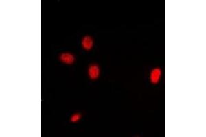 Immunofluorescent analysis of ING3 staining in Hela cells. (ING3 antibody)