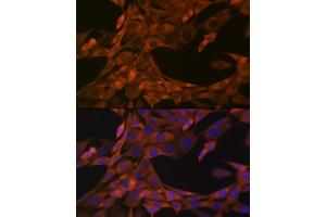 Immunofluorescence analysis of NIH-3T3 cells using HE4/WFDC2 Rabbit mAb (ABIN1682653, ABIN3017632, ABIN3017633 and ABIN7101513) at dilution of 1:100 (40x lens). (WFDC2 antibody)