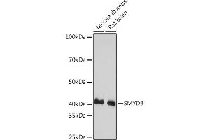 Western blot analysis of extracts of various cell lines, using SMYD3 Rabbit mAb (ABIN3015902, ABIN3015903, ABIN1680302 and ABIN1680303) at 1:1000 dilution. (SMYD3 antibody)