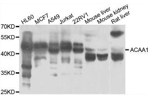 Western blot analysis of extracts of various cell lines, using ACAA1 antibody. (ACAA1 antibody  (AA 27-300))