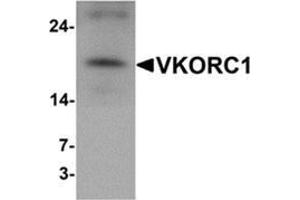 Western blot analysis of VKORC1 in A549 cell lysate with VKORC1 antibody at 1 ug/mL.