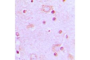 Immunohistochemical analysis of SRSF7 staining in human brain formalin fixed paraffin embedded tissue section. (SFRS7 antibody  (Center))