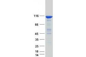 Validation with Western Blot (GBA2 Protein (Myc-DYKDDDDK Tag))
