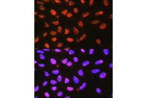 Immunofluorescence analysis of L929 cells using P4H Rabbit pAb (0538) at dilution of 1:100 (40x lens). (P4HA1 antibody  (AA 235-534))