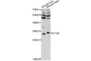 Western blot analysis of extracts of various cell lines, using OTX2 antibody. (OTX2 antibody)