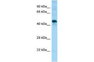 WB Suggested Anti-Sgms1 Antibody Titration: 1.