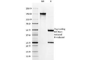 SDS-PAGE Analysis Purified Cytokeratin 6A (KRT6A) Mouse Monoclonal Antibody (KRT6A/2368). (KRT6A antibody)