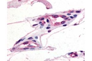 Immunohistochemical (Formalin/PFA-fixed paraffin-embedded sections) staining of human capillaries with GPR21 polyclonal antibody . (GPR21 antibody)