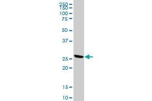 KLK10 polyclonal antibody (A01), Lot # 051011JC01 Western Blot analysis of KLK10 expression in A-431 . (Kallikrein 10 antibody  (AA 167-276))