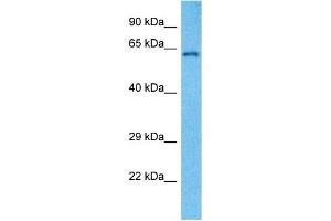 Host:  Mouse  Target Name:  HNRNPL  Sample Tissue:  Mouse Liver  Antibody Dilution:  1ug/ml