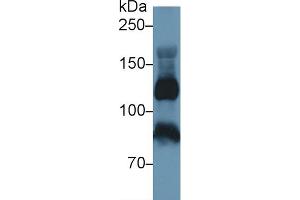 Western Blotting (WB) image for anti-Inter alpha Globulin Inhibitor H4 (ITIH4) (AA 29-157) antibody (ABIN7436555)