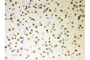 Anti- PKC iota Picoband antibody,IHC(P) IHC(P): Rat Brain Tissue (PKC iota antibody  (AA 21-214))