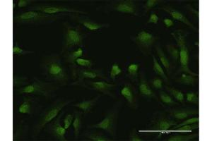Immunofluorescence of purified MaxPab antibody to IKZF1 on HeLa cell. (IKZF1 antibody  (AA 1-477))