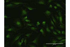 Immunofluorescence of purified MaxPab antibody to IKZF1 on HeLa cell.