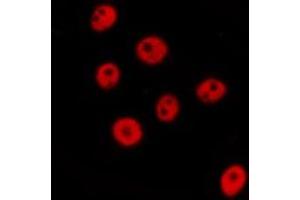 ABIN6277676 staining  NIH-3T3 cells by IF/ICC. (FLI1 antibody  (Internal Region))