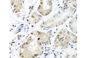 Immunohistochemistry of paraffin-embedded Human stomach using PCBP1 Polyclonal Antibody at dilution of 1:100 (40x lens). (PCBP1 antibody)