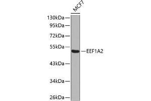 Western blot analysis of extracts of MCF-7 cells, using EEF1 antibody (ABIN6129010, ABIN6139947, ABIN6139948 and ABIN6223167). (EEF1A2 antibody  (AA 184-463))