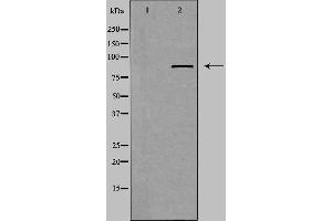 Western blot analysis of extracts from Jurkat cells using ZFYVE20 antibody. (Rabenosyn 5 antibody  (Internal Region))