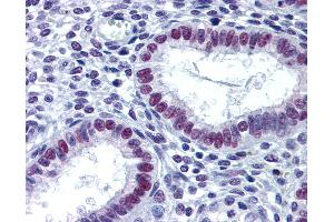 Anti-KDM1A / LSD1 antibody IHC of human uterus.