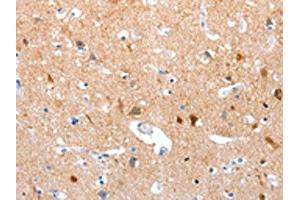 The image on the left is immunohistochemistry of paraffin-embedded Human brain tissue using ABIN7190855(GPR6 Antibody) at dilution 1/10, on the right is treated with synthetic peptide. (GPR6 antibody)