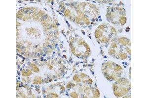 Immunohistochemistry of paraffin-embedded Human stomach using PMPCB Polyclonal Antibody at dilution of 1:100 (40x lens).