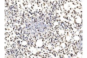 IHC analysis of DBC-1/CCAR2 using anti-DBC-1/CCAR2 antibody (ABIN7602235). (CCAR2 antibody  (AA 65-917))