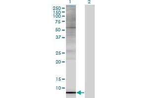 Western Blot analysis of ARL9 expression in transfected 293T cell line by ARL9 monoclonal antibody (M02A), clone 7A2.