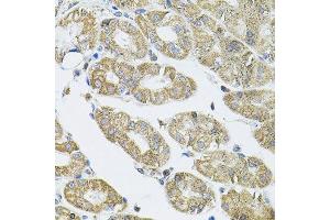 Immunohistochemistry of paraffin-embedded human stomach using VEPH1 antibody. (VEPH1 antibody  (AA 448-547))