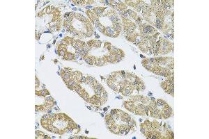 Immunohistochemistry of paraffin-embedded human stomach using VEPH1 antibody. (VEPH1 antibody  (AA 448-547))