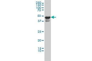 MDS028 monoclonal antibody (M04), clone 2E8 Western Blot analysis of MDS028 expression in HL-60 . (ITFG2 antibody  (AA 1-447))