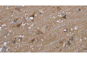Immunohistochemistry of paraffin-embedded Human brain using PTK2B Polyclonal Antibody at dilution of 1:50 (PTK2B antibody)