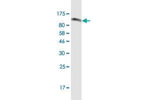 Western Blot detection against CHD11-His tag (61. (OB Cadherin antibody  (AA 54-612))