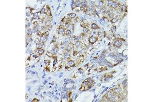 Immunohistochemistry (IHC) image for anti-Carnitine Palmitoyltransferase 2 (CPT2) (AA 1-180) antibody (ABIN6138983)