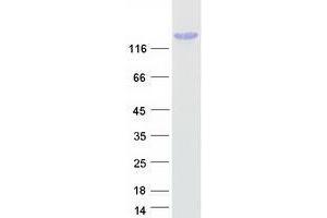 Validation with Western Blot