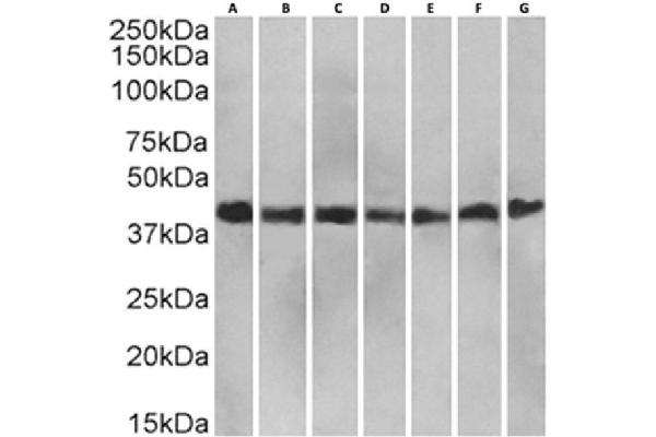Recombinant LRPAP1 antibody
