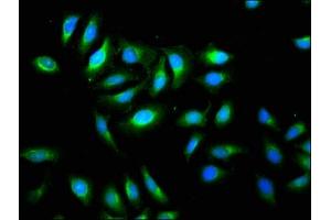 Immunofluorescence staining of A549 cells with ABIN7173123 at 1:133, counter-stained with DAPI. (TMEM192 antibody  (AA 193-271))