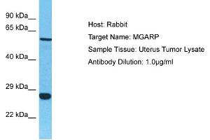 Host: Rabbit Target Name: MGARP Sample Tissue: Human Uterus Tumor Antibody Dilution: 1ug/ml (C4orf49 antibody  (C-Term))