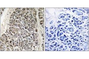Immunohistochemistry analysis of paraffin-embedded human pancreas tissue, using MRPS21 Antibody. (MRPS21 antibody  (AA 38-87))