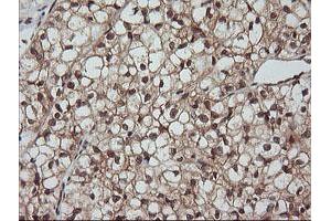 Image no. 1 for anti-Leucine Zipper and CTNNBIP1 Domain Containing (LZIC) antibody (ABIN1499239) (LZIC antibody)