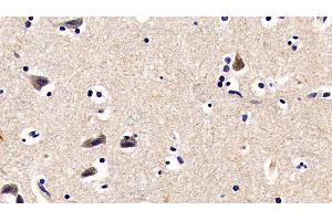 Immunohistochemistry (IHC) image for anti-Fibromodulin (FMOD) (AA 19-376) antibody (ABIN7433693)