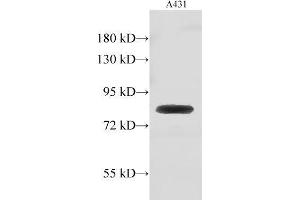 Western Blot analysis of A431 cell using GUSB Polyclonal Antibody at dilution of 1:500 (Glucuronidase beta antibody)