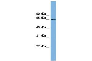 WB Suggested Anti-C8orf45 Antibody Titration: 0. (C8orf45 antibody  (Middle Region))