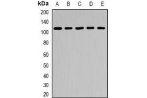 Western blot analysis of ARHGAP44 expression in MCF7 (A), 293T (B), mouse heart (C), mouse lung (D), rat brain (E) whole cell lysates.