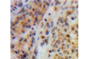 Used in DAB staining on fromalin fixed paraffin-embedded Ovary tissue (TOP2 antibody  (AA 923-1148))